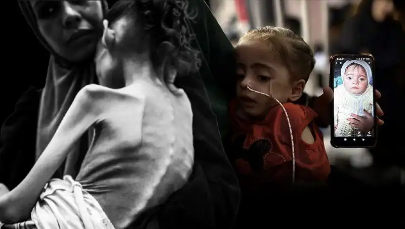 Meryem'in Dramı: 25 Kilodan 10 Kiloya Düşüşüyle Açlıkla Savaş