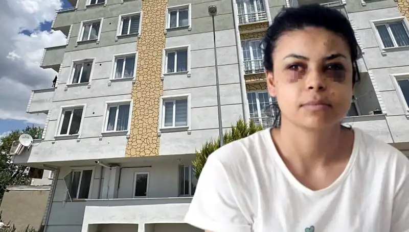 Düğün Töreninde Maganda Kurşunu Korkuttu: Göz Yaralanmaları Artıyor