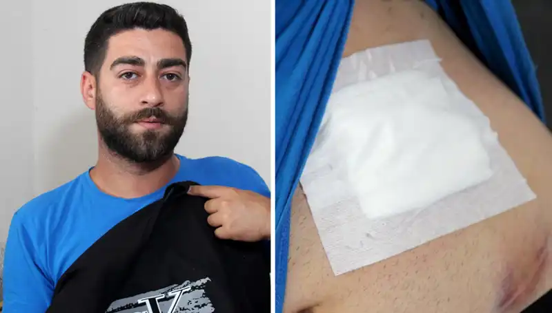 Karnında Ağrı Hissetti, Gerçek Röntgende Şok Edici Sonuç Ortaya Çıktı
