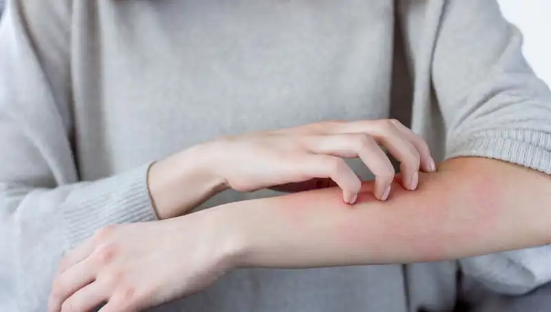 Cilt Kanserinin Gözden Kaçan İki Belirtisi Nedir? Dermatologdan Açıklamalar