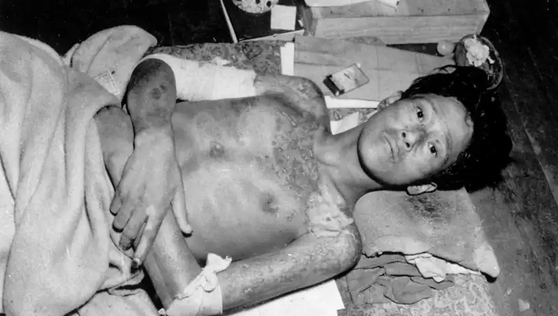 80 Yıl Sonra Nagasaki: Nükleer Tehditler İle Çağrı Yükseliyor